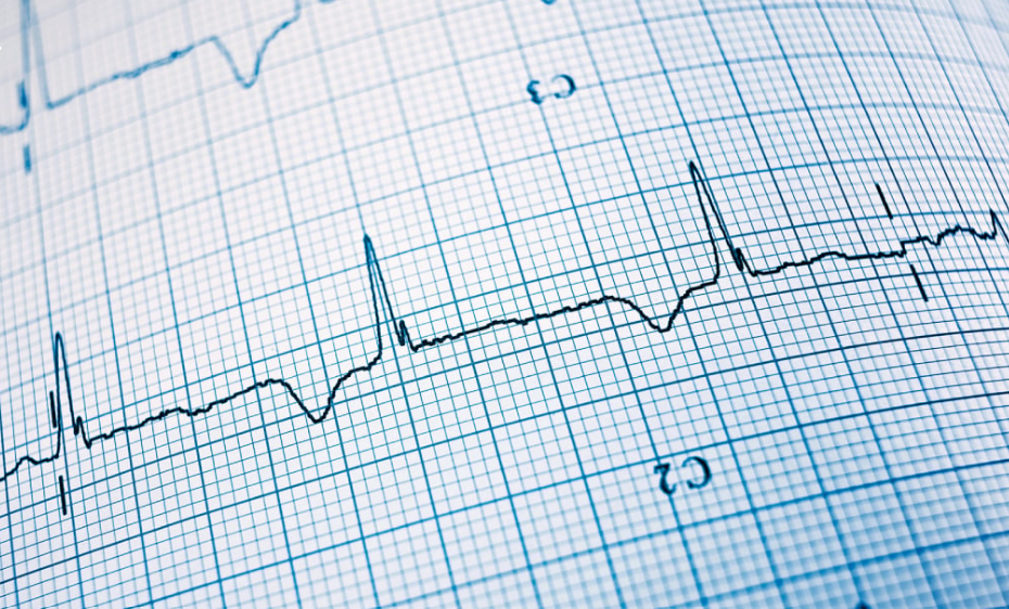 Էլեկտրոսրտագրություն, էխոսրտագրություն